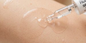 Spicules in Skincare: What They Are & How They Work
